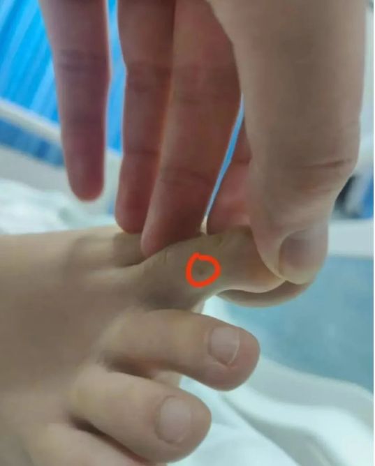 女子三亚旅游被蛇咬至身亡过程及进展:官方介入家属称或考虑尸检(图4)