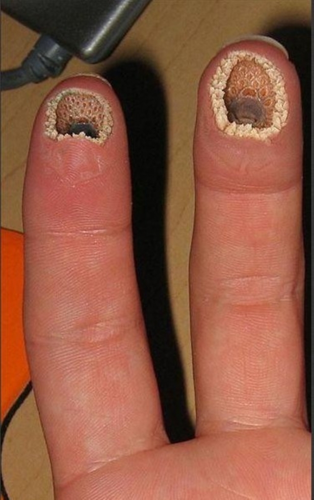 重度密集恐惧症患者慎入